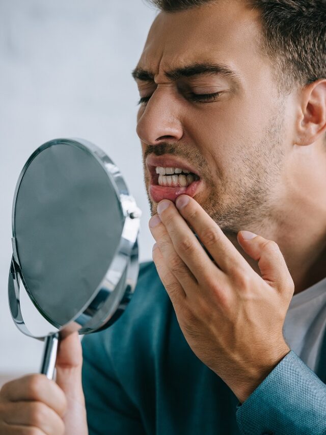 मुँह के छाले को कैसे ठीक करे? मुँह के छाले सभी लोगों को कभी न कभी होते ही है, जो सामान्य है आइये जानते है इलाज |