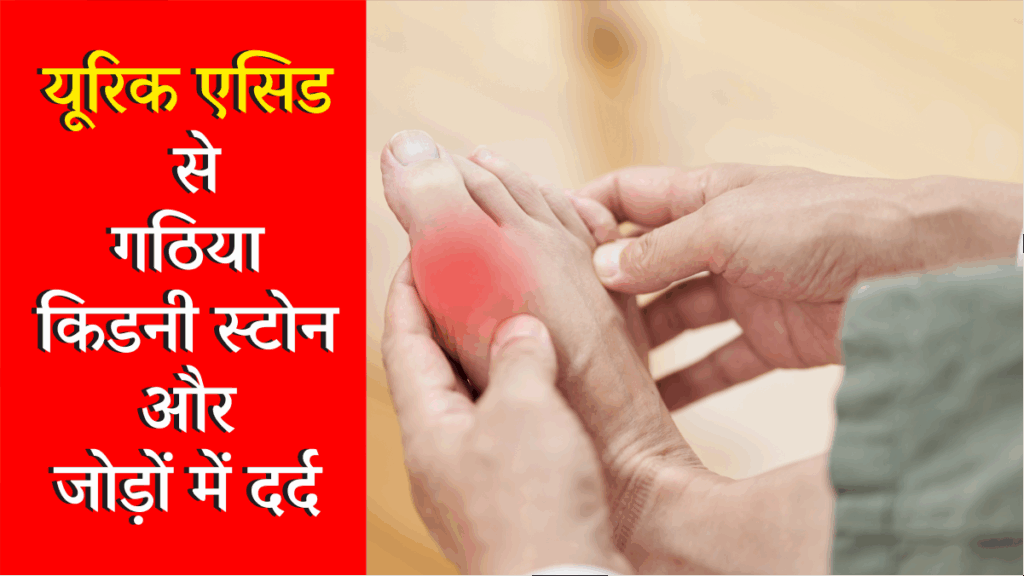 Uric Acid