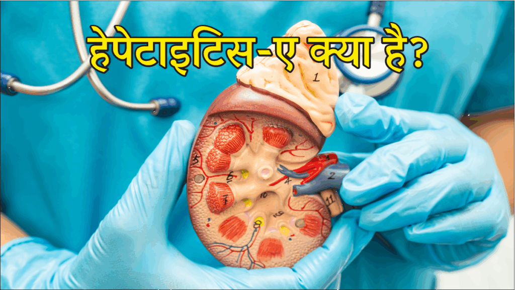 Hepatitis A